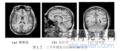 图 1.2 三个不同方向的脑部 MR 图像