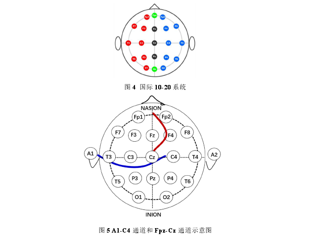 图 5 A1-C4 通道和 Fpz-Cz 通道示意图