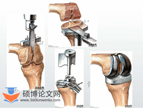 医学论文参考